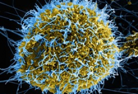 República Democrática del Congo lanza una nueva vacuna contra el ébola en dos zonas del este