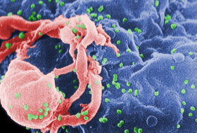 Diseñan el sistema inmunitario para que pueda combatir al VIH