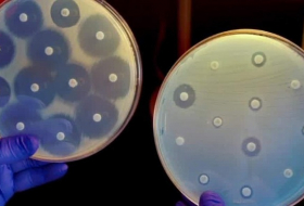 La superbacteria resistente a los antibióticos que preocupa a Estados Unidos
