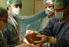 Un cirujano admite que tatuó su firma con láser en el hígado trasplantado de un paciente