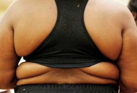 Descubren que la obesidad y el sobrepeso desencadenan al menos doce tipos de cáncer