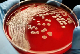 Hallan infección resistente al antibiótico más potente del mundo