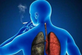 Cáncer de pulmón causa 60 mil muertes al año en Latinoamérica