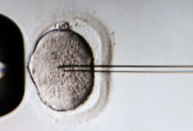 ¿Será posible cambiar el ADN? Japón busca legalizar la 'redacción' de genes en embriones humanos