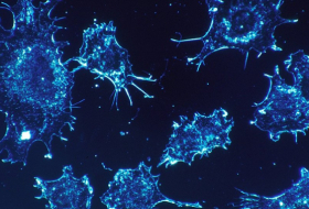 Microchips con puntos cuánticos incrementan la eficacia de la terapia contra el cáncer