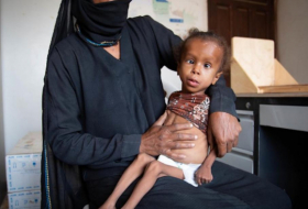 Doce millones enfrentan la peor hambruna en la historia de Yemen
