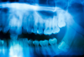 Un pigmento azul en los dientes revela una sorprendente cualidad de las mujeres medievales