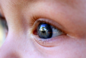   EE.UU.  : Detectan 10 tumores en el ojo de una niña de 2 años
