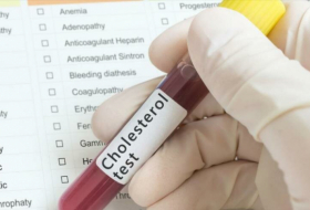 El 95 % de latinoamericanos no sabe que padece colesterol alto