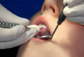 Una mujer muere desangrada luego de que dentista le extrajera diez dientes