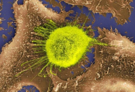 Científicos diseñan un virus que mata todos los tipos de cáncer