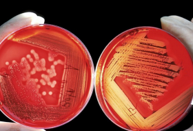   Alianza letal  : dos cepas de bacterias 'comecarne' se combinan para causar una infección mortal