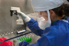 Científicos australianos cultivan una cepa del coronavirus, ¿para qué?