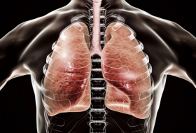 Otra razón para abandonar el tabaco: al dejar de fumar, los pulmones empiezan a regenerarse