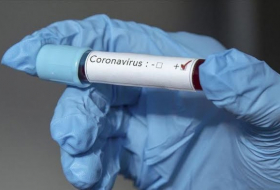 Casos de covid-19 en el mundo superan los 75 millones de contagios
