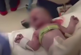 Científicos graban los pulmones de recién nacidos durante su primera respiración (VIDEO)