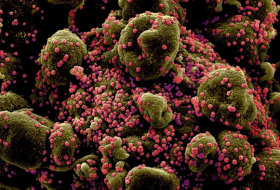 La variante británica del coronavirus puede ser hasta dos veces más mortal que otras, según un estudio