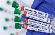   La OMS entregó 3000 tests de viruela del mono     a Azerbaiyán  