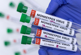   La OMS entregó 3000 tests de viruela del mono     a Azerbaiyán  