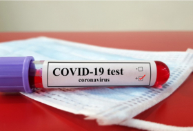   Azerbaiyán detecta 72 nuevos casos de COVID-19  