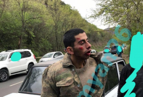  Los armenios torturan al militar azerbaiyano desaparecido -  FOTO+VIDEO  