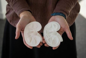 Bioingenieros plantean la creación de órganos funcionales con impresoras 3D