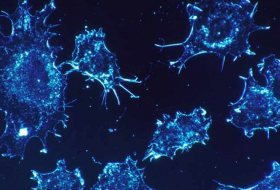Científicos rusos crean nanopartículas capaces de destruir el cáncer