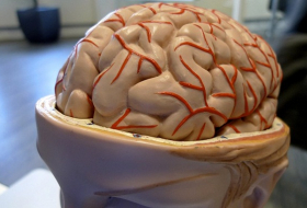 El tamaño del cerebro influye en el trastorno por déficit de atención