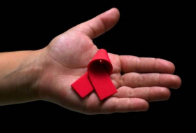 ONG: aumento del VIH en Chile es real